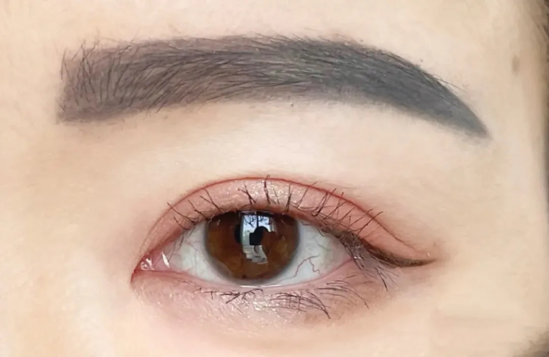 医我看 ｜破解高危患者“心难题”！珠海医生采用国产球扩瓣完成高难度心脏手术